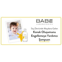 Babe Pediatric Cradle Cap Shampoo - Bebek Şampuanı 200 ml - 4