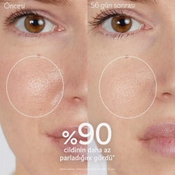 Caudalie Vinopure Akne Karşıtı Arındırıcı Tonik 200 ml - 3