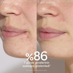 Caudalie Vinopure Akne Karşıtı Salisilik Serum 30 ml - 3