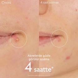 Caudalie Vinopure Akne Karşıtı Salisilik Spot Krem 15ml - 3