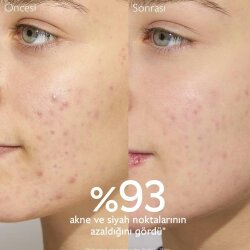 Caudalie Vinopure Moisturizing Mattifying Fluid Matlaştırıcı Nemlendirici 40 ml - 5