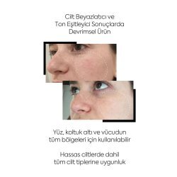 Clasy Care Pigment Corrector Beyazlatıcı ve Cilt Tonu Eşitleyici Krem 100ml - 3