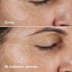 Clinique Clarifying Lotion 3 - Yağlı Ciltler İçin Temizleyici Tonik 200ml - 5