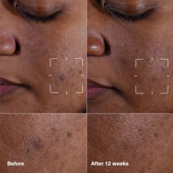 Clinique Even Better Clinical Koyu Leke Karşıtı Serum 50 ml - 2