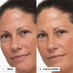 Dr.Jart+ Prejuvenation Sıkılaştırıcı Yaşlanma Karşıtı Krem 50ml - 2