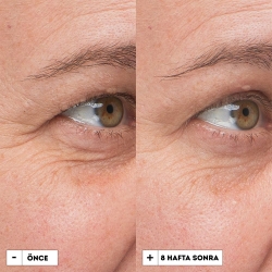 Dr.Jart+ Prejuvenation Yaşlanma Karşıtı Sıkılaştırıcı Serum - 2