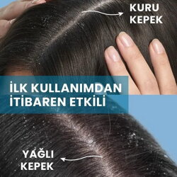 Ducray Kelual Squanorm Kepek Karşıtı Losyon 200 ml - 4