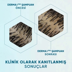 Head & Shoulders DermaXPro Uzman Saç Derisi Bakım Yatıştırıcı Şampuan 300ml - 4