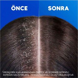 Head & Shoulders Ekstra Hacim Kepeğe Karşı Etkili Şampuan 330ml - 4