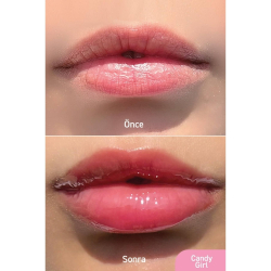 Herbaderm Lip Shine Balm - Candy Girl 10 ml - 3