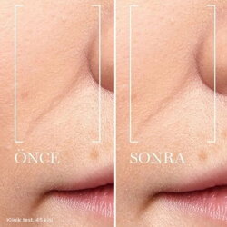 Lancome Renergie Triple Serum 20ml - 4