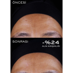 Lancome Renergie Triple Serum - Retinol Saf Retinol Saf C Vitamini X Peptit 20ml - 11