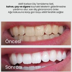 Luis Bien Aktif Karbon Diş Macunu 75ml - Luis Bien (1)