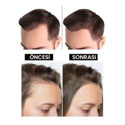 Luis Bien Kara Sarımsak Yağı 50ml - 4