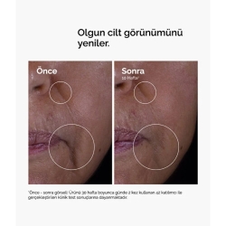 The Ordinary GF 15% Solution Olgun Cilt Bakım Serumu 30ml - 3