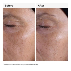 The Ordinary Glycolic Acid 7% Exfoliating Aydınlatmaya ve Pürüzsüzleştirmeye Yardımcı Tonik 100ml - 3