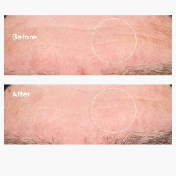 The Ordinary Hyaluronic Acid 2% B5 Derinlemesine Nemlendirici Serum 30ml - The Ordinary (1)