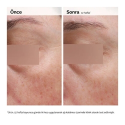 The Ordinary Niacinamide 5% Yüz ve Vücut Emülsiyonu 100ml - The Ordinary (1)