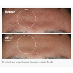 The Ordinary Niacinamide Leke ve Gözenek Görünümü Karşıtı Serum 60ml - 3