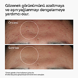 The Ordinary Niacinamide 10% + Zinc 1% - Leke ve Gözenek Görünümü Karşıtı Serum 60ml - The Ordinary (1)