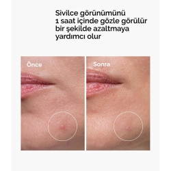 The Ordinary Sulfur 10% Sivilce Görünümü Karşıtı Toz Krem 5gr - 3