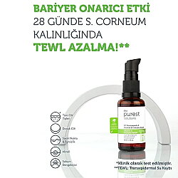 The Purest Solutions Vita-b Complex Niacinamide 10% Serum Bariyer Güçlenmeye Yardımcı - 5