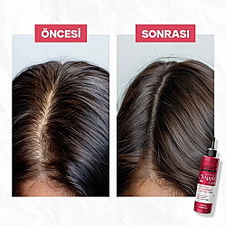 Urban Care No.2 Expert Apple Cider Kepek Karşıtı Tonik 200ml - 3