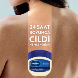 Vaseline Original Nemlendirici Jel Krem 100ml - 3