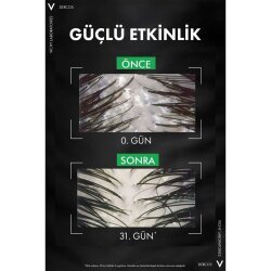 Vichy Dercos Anti Dandruff Kepek Karşıtı Şampuan 390ml - Refill - 4