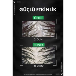 Vichy Dercos Anti Dandruff Kepek Karşıtı Şampuan 390ml - Refill - 7
